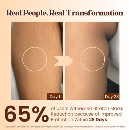 Fix Derma Strallium Stretch Mark Cream