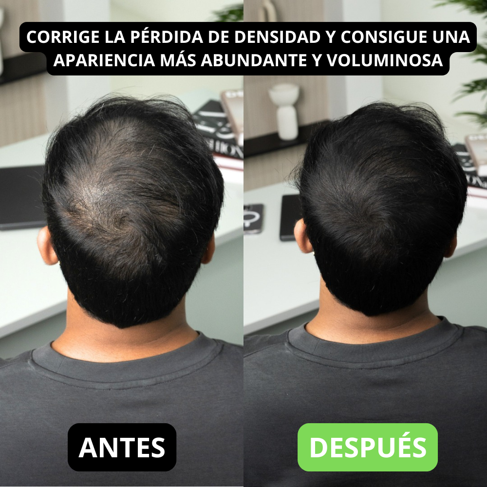 Hair Volume Powder for Men & women