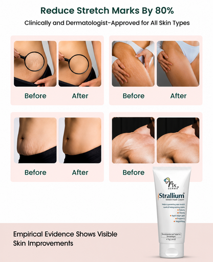 Fix Derma Strallium Stretch Mark Cream