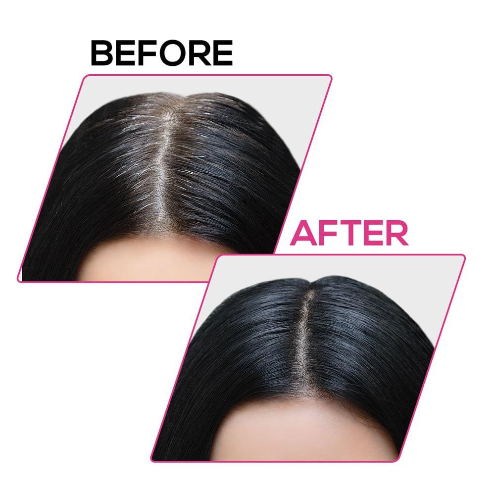 Hair Volume Powder for Men & women