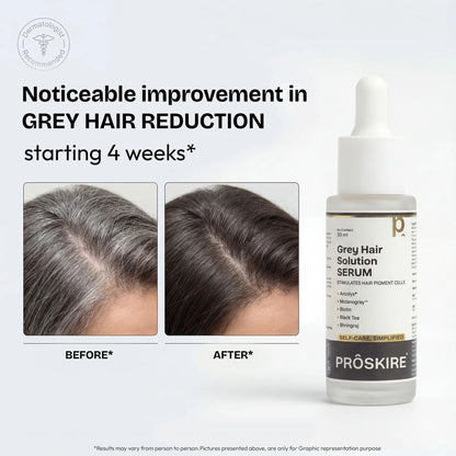 Grey Hair Solution Serum